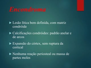 Encondroma
 Lesão lítica bem definida, com matriz
condróide
 Calcificações condróides: padrão anelar e
de arcos
 Expansão do córtex, sem ruptura da
cortical
 Nenhuma reação periosteal ou massa de
partes moles
 