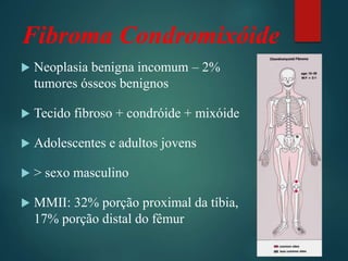 Fibroma Condromixóide
 Neoplasia benigna incomum – 2%
tumores ósseos benignos
 Tecido fibroso + condróide + mixóide
 Adolescentes e adultos jovens
 > sexo masculino
 MMII: 32% porção proximal da tíbia,
17% porção distal do fêmur
 