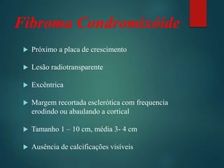 Fibroma Condromixóide
 Próximo a placa de crescimento
 Lesão radiotransparente
 Excêntrica
 Margem recortada esclerótica com frequencia
erodindo ou abaulando a cortical
 Tamanho 1 – 10 cm, média 3- 4 cm
 Ausência de calcificações visíveis
 