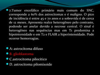 7.Tumor encefálico primário mais comum do SNC,
corresponde a 60% dos astrocitomas e é maligno. O pico
de incidência é entre 45 e 70 anos e a sobrevida é de cerca
de 12 meses. Apresenta realce heterogêneo pelo contraste,
podendo ser anelar devido a necrose central. O sinal é
heterogêneo nas sequências mas em T1 predomina a
hipointensidade e em T2 e FLAIR a hiperintensidade. Pode
ocorrer hemorragias.
A: astrocitoma difuso
B. glioblastoma
C.astrocitoma pilocítico
D. astrocitoma pilomixoide
 
