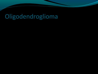 Oligodendroglioma
 