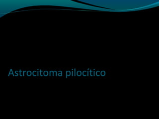 Astrocitoma pilocítico
 