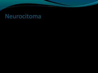 Neurocitoma
 