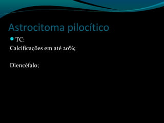 Astrocitoma pilocítico
TC:
Calcificações em até 20%;
Diencéfalo;
 