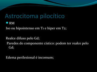 Astrocitoma pilocítico
RM
Iso ou hipointenso em T1 e hiper em T2;
Realce difuso pelo Gd;
Paredes do componente cístico: podem ter realce pelo
Gd;
Edema perilesional é incomum;
 