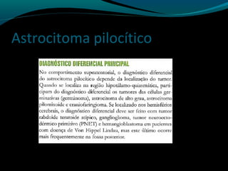 Astrocitoma pilocítico
 