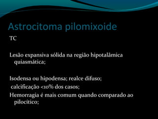 Astrocitoma pilomixoide
TC
Lesão expansiva sólida na região hipotalâmica
quiasmática;
Isodensa ou hipodensa; realce difuso;
calcificação <10% dos casos;
Hemorragia é mais comum quando comparado ao
pilocítico;
 
