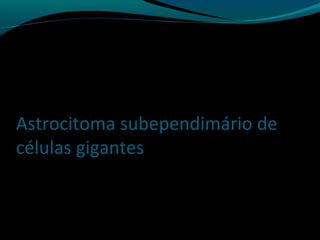 Astrocitoma subependimário de
células gigantes
 