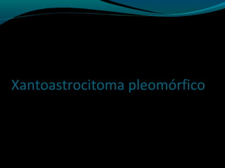 Xantoastrocitoma pleomórfico
 