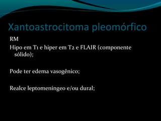 Xantoastrocitoma pleomórfico
RM
Hipo em T1 e hiper em T2 e FLAIR (componente
sólido);
Pode ter edema vasogênico;
Realce leptomeníngeo e/ou dural;
 