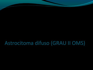 Astrocitoma difuso (GRAU II OMS)
 