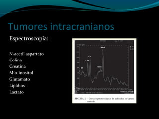 Tumores intracranianos
Espectroscopia:
N-acetil aspartato
Colina
Creatina
Mio-inositol
Glutamato
Lipídios
Lactato
 