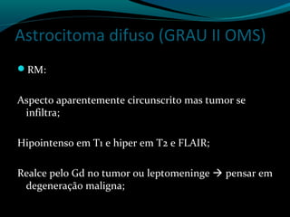 Astrocitoma difuso (GRAU II OMS)
RM:
Aspecto aparentemente circunscrito mas tumor se
infiltra;
Hipointenso em T1 e hiper em T2 e FLAIR;
Realce pelo Gd no tumor ou leptomeninge  pensar em
degeneração maligna;
 
