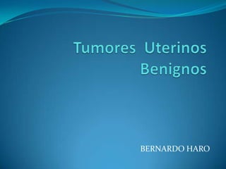 Tumores  Uterinos Benignos BERNARDO HARO 