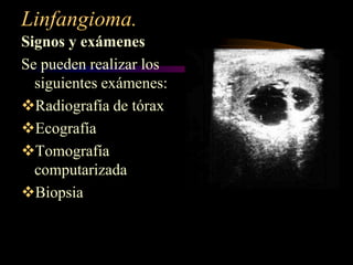 Linfangioma.Signos y exámenesSe pueden realizar los siguientes exámenes:Radiografía de tórax
