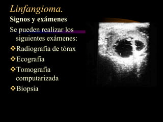 Linfangioma.<br />Signos y exámenes<br />Se pueden realizar los siguientes exámenes:<br /><ul><li>Radiografía de tórax