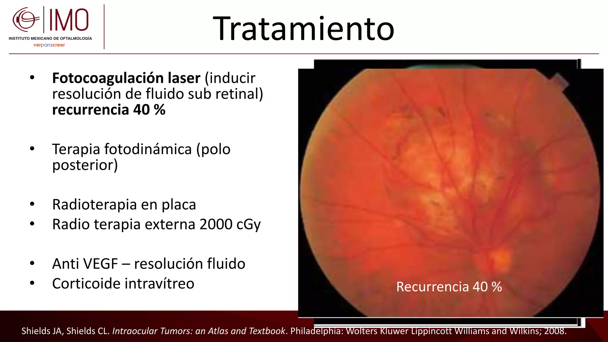 Tumores vasculares de la retina y coroides - Vascular tumors of the ...