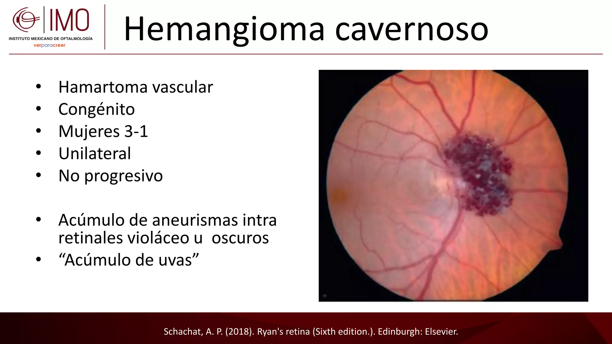 Tumores vasculares de la retina y coroides - Vascular tumors of the ...