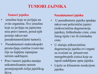 Tumori Jajnika Pptx