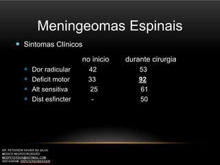 Meningeomas Espinais
 Sintomas Clínicos
no inicio durante cirurgia
 Dor radicular 42 53
 Deficit motor 33 92
 Alt sensitiva 25 61
 Dist esfincter - 50
 