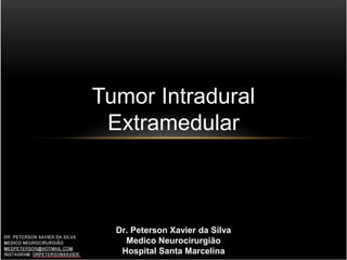 Tumor Intradural
Extramedular
Dr. Peterson Xavier da Silva
Medico Neurocirurgião
Hospital Santa Marcelina
 