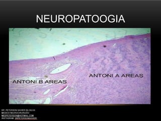 NEUROPATOOGIA
 