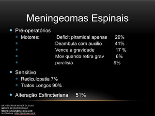 Meningeomas Espinais
 Pré-operatórios
 Motores: Deficit piramidal apenas 26%
 Deambula com auxilio 41%
 Vence a gravidade 17 %
 Mov quando retira grav 6%
 paralisia 9%
 Sensitivo
 Radiculopatia 7%
 Tratos Longos 90%
 Alteração Esfincteriana 51%
 