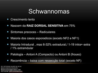 Schwannomas
 Crescimento lento
 Nascem da RAIZ DORSAL SENSITIVA em 75%
 Sintomas precoces – Radiculares
 Maioria dos casos esporadicos (exceto NF2 e NF1)
 Maioria Intradural , mas 6-32% extradural,/ 1-19 intra+ extra
/ 1% extramdular
 Patologia – Antoni A (Compacto) ou Antoni B (frouxo)
 Recorrência – baixa com ressecção total (exceto NF)
 