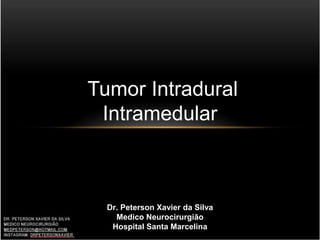 Tumor Intradural
Intramedular
Dr. Peterson Xavier da Silva
Medico Neurocirurgião
Hospital Santa Marcelina
 