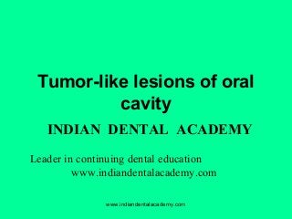 Tumor-like lesions of oral
cavity
INDIAN DENTAL ACADEMY
Leader in continuing dental education
www.indiandentalacademy.com
www.indiandentalacademy.com

 