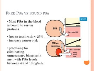 FREE PSA VS BOUND PSA
•Most PSA in the blood
is bound to serum
proteins
•free to total ratio < 25%
- increase cancer risk
•promising for
eliminating
unnecessary biopsies in
men with PSA levels
between 4 and 10 ng/mL.
 