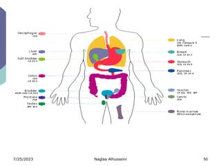 7/25/2023 Naglaa Alhusseini 50
 