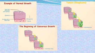 BIOCHEMICAL ASPECTS OF CANCER AND TUMOR MARKERS | PPTX