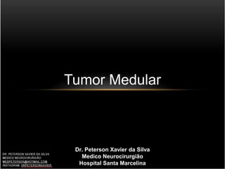Tumor Medular
Dr. Peterson Xavier da Silva
Medico Neurocirurgião
Hospital Santa Marcelina
 