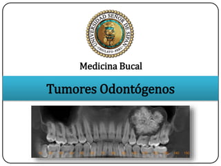 Tumores Odontógenos
Medicina Bucal
 