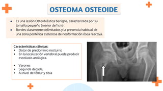OSTEOMA OSTEOIDE
● Es una lesión Osteoblástica benigna, caracterizada por su
tamaño pequeño (menor de 1 cm)
● Bordes claramente delimitados y la presencia habitual de
una zona periférica esclerosa de neoformación ósea reactiva.
Características clínicas:
 Dolor de predominio nocturno
 En la localización vertebral puede producir
escoliasis antálgica.
 Varones
 Segunda década,
 Al nivel de fémur y tibia
 