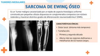 SARCOMA DE EWING ÓSEO
Es un "tumor maligno caracterizado por un tejido de aspecto histológico uniforme
constituido por pequeñas células dispuestas en conglomerados compactos con núcleos
redondos y muestran distintos grados de diferenciación neuroectodérmica" (OMS).
CARACTERÍSTICAS CÍNICAS:
• Dolor local (síntoma más temprano)
• Tumefacción.
o Primera y segunda década
o Afecta más las regiones diafisiarias o
metafisarias de los huesos largos.
TUMORES MEDULARES
 
