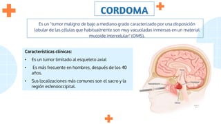 CORDOMA
Es un "tumor maligno de bajo a mediano grado caracterizado por una disposición
lobular de las células que habitualmente son muy vacuoladas inmersas en un material
mucoide intercelular" (OMS).
Características clínicas:
• Es un tumor limitado al esqueleto axial
• Es más frecuente en hombres, después de los 40
años.
• Sus localizaciones más comunes son el sacro y la
región esfenooccipital.
 