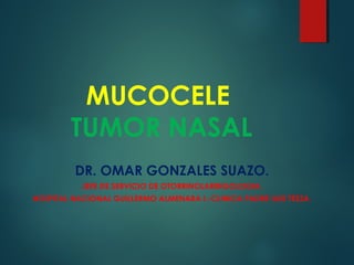 MUCOCELE
TUMOR NASAL
DR. OMAR GONZALES SUAZO.
JEFE DE SERVICIO DE OTORRINOLARINGOLOGIA.
HOSPITAL NACIONAL GUILLERMO ALMENARA I.-CLINICA PADRE LUIS TEZZA.
 