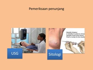 Pemeriksaan penunjang
USG Sitologi
 