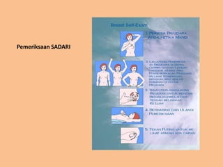 Pemeriksaan SADARI
 