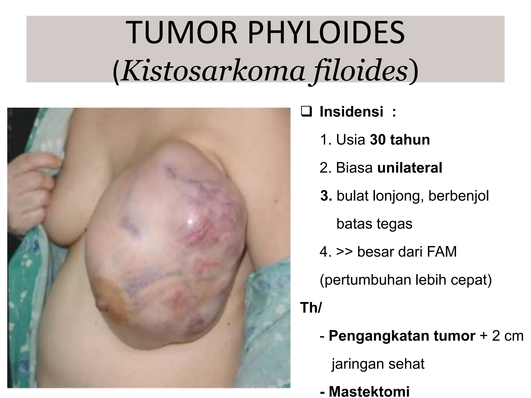  Insidensi :
1. Usia 30 tahun
2. Biasa unilateral
3. bulat lonjong, berbenjol
batas tegas
4. >> besar dari FAM
(pertumbuhan lebih cepat)
Th/
- Pengangkatan tumor + 2 cm
jaringan sehat
- Mastektomi
TUMOR PHYLOIDES
(Kistosarkoma filoides)
 