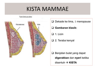  Dekade ke lima,  menopause
 Gambaran klasik:
 1. Licin
 2. Teraba kenyal
 Benjolan bulat yang dapat
digerakkan dan nyeri ketika
disentuh  KISTA
KISTA MAMMAE
 