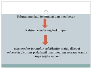 Saluran menjadi tersumbat dan membesar
Kalsium cenderung terkumpul
clustered or irregular calcifications atau disebut
microcalcificatons pada hasil mammogram seorang wanita
tanpa gejala kanker.
 