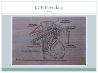 KGB Payudara
 