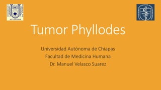Tumor Phyllodes
Universidad Autónoma de Chiapas
Facultad de Medicina Humana
Dr. Manuel Velasco Suarez
 
