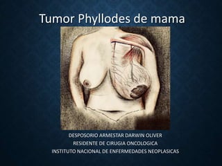 Tumor Phyllodes de mama
DESPOSORIO ARMESTAR DARWIN OLIVER
RESIDENTE DE CIRUGIA ONCOLOGICA
INSTITUTO NACIONAL DE ENFERMEDADES NEOPLASICAS
 