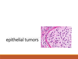 epithelial tumors
 