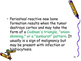 Periosteal reactive new bone formation results when the tumor destroys cortex and may take the form of a Codman's triangle, "onion-skinning," or a "sunburst" pattern. It usually is a sign of malignancy but may be present with infection or histiocytosis.28