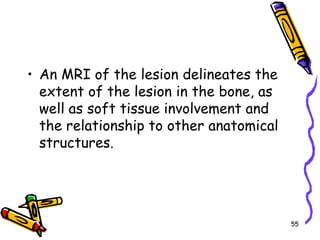 An MRI of the lesion delineates the extent of the lesion in the bone, as well as soft tissue involvement and the relationship to other anatomical structures. 55